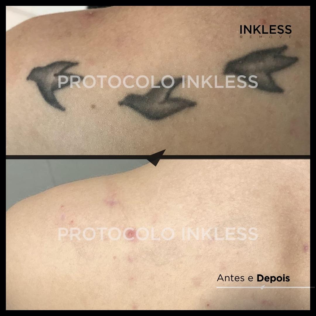 Resultado de remoção INKLESS - caso 9