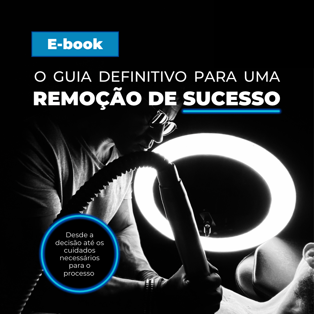 Capa do E-book: Guia Definitivo para uma Remoção de Sucesso - INKLESS